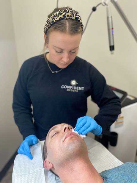 This is an image of a Man having a Microneedling Session at Confident MedSpa.