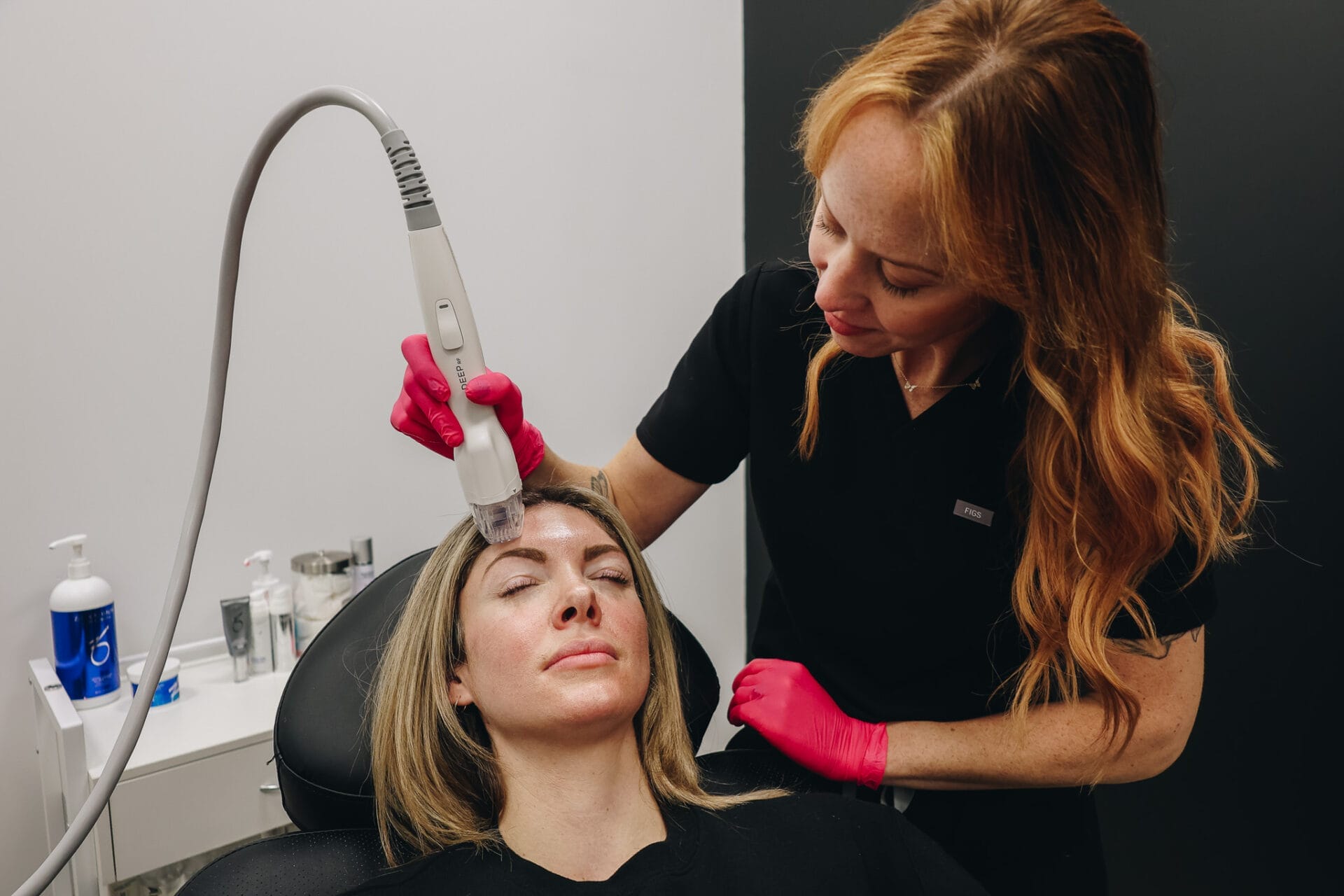 microneedling